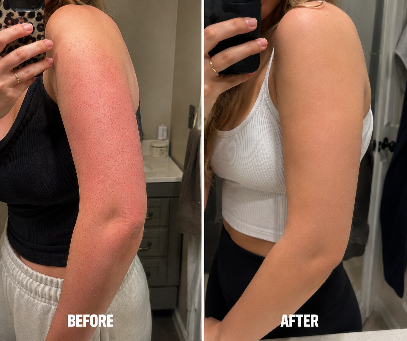 Before and after — Priya K.